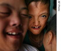 A group of boys play together at a center for Agent Orange victims in Danang, Vietnam (File)